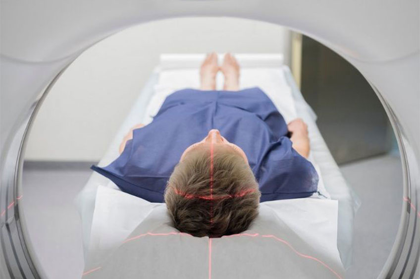Next-Gen Micro-CT Scan Can Lower Radiation, Offer Better Pictures